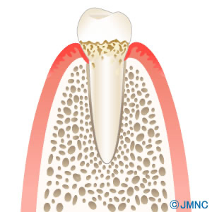 骨量や歯の状態を確認